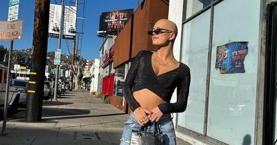 Model bald from alopecia was so mortified she wore wig to shower - now she loves her look