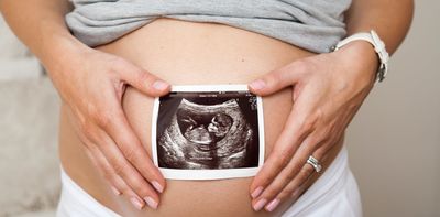 Surrogacy shake up in UK would create uneven treatment for birth mothers