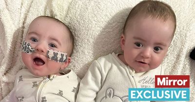 Mum told both her baby twins had tragically not made it - before hearing miracle cries
