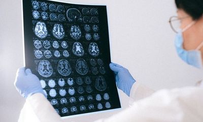 Study suggests how cancer spreads to the brain
