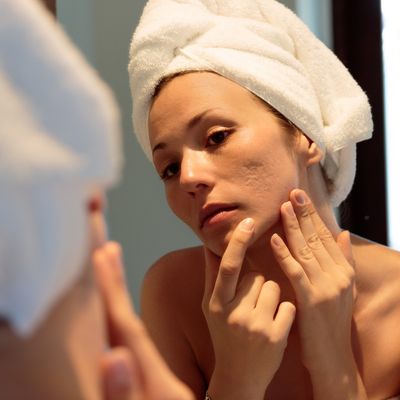 Can a Retinoid Help Treat Acne Scars? Experts Explain