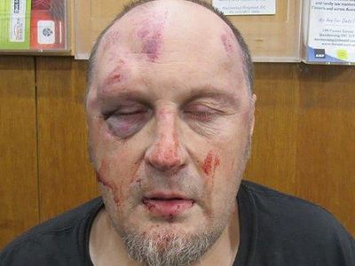 Man badly injured in case of mistaken identity