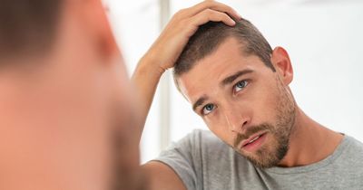 Hair anxiety on rise as two thirds of young adults already suffering pattern baldness