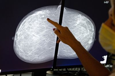 ChatGPT gave advice on breast cancer screenings in a new study. Here's how well it did