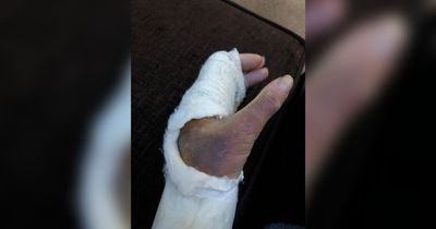 Mum screamed 'you've broken my hand' after waking up in hospital