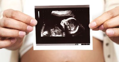 Pregnant woman furious after family member uses baby's name for pet dog