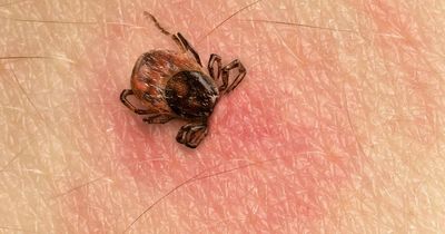 What is encephalitis? Symptoms of rare tick-borne virus in UK explained