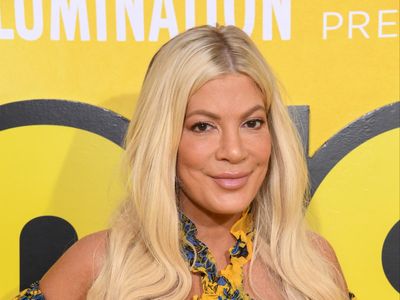 Tori Spelling reveals she developed eye ulcer after sleeping in contact lenses: ‘It’s my fault’