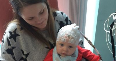 Baby had 100 seizures a day before surgeons had to remove part of his brain