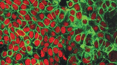 Scientists Create Implanted Battery to Fight Cancer