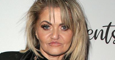 Danniella Westbrook gearing up for ‘major’ surgery to help correct ‘collapsing face’