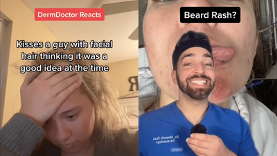 A TikTok Dermatologist Revealed Why Pashing Folks W/ Facial Hair Is Dangerous Say Less, Doll