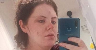 Pregnant woman held hostage by ex who 'slashed her stomach' in threat to perform DIY cesarean