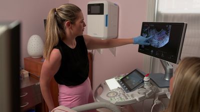Imaging and artificial intelligence key to diagnosing endometriosis without surgery, research finds