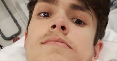 Teen left a week from death after being told his serious symptoms were acid reflux