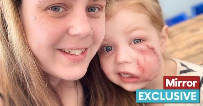 Girl, 4, has 40 stitches after American Bulldog mauls her - before mum punched dog to save her life