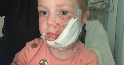 Mum punched and kicked dog as it attacked her 4-year-old daughter