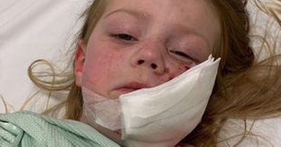 Girl, 4, has 40 stitches in face after American Bulldog mauls her