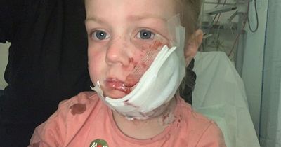 Four-year-old girl has 40 stitches on face after being attacked by American Bulldog