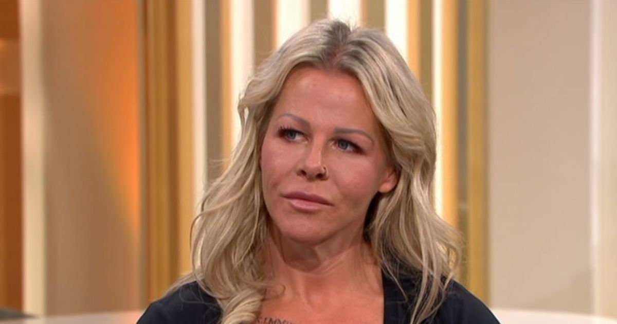 British woman woke up after botched plastic surgery…