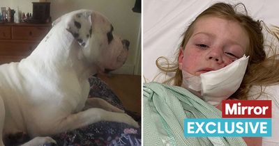 American Bulldog pictured that ripped apart face of girl, 4, who needed 40 stitches