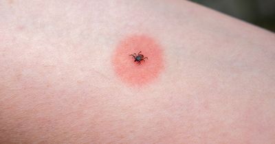 Vaccine may be needed to protect against deadly tick-borne virus, expert warns