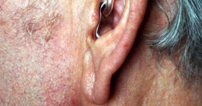 Hearing aids could help protect against dementia