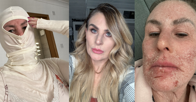 Scots beauty therapist 'addicted' to steroid creams for decades covers rashes with balaclava