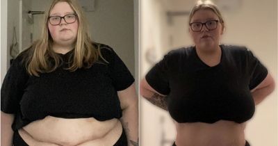 Woman who weighed 29 stone looks unrecognisable after £3,500 gastric sleeve surgery