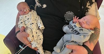 Baby 'knows a piece of him is missing' after twin's death