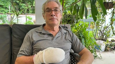 Man loses index finger during dog attack in Far North Queensland