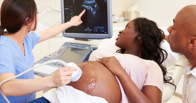 Tories must stop Black women being FOUR times more likely to die in childbirth