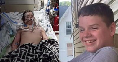 Boy, 13, dies from sick Benadryl TikTok challenge as dad shares tragic death bed image