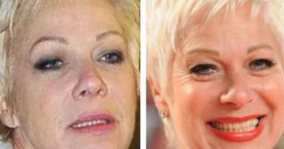 Loose Women's Denise Welch celebrates 11 years of sobriety with before and after pics