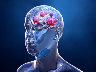 Is that a tumour in your brain? 5 often ignored risk factors of brain tumour