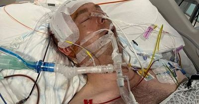 Dad in coma after being 'punched' following Grand National stag do