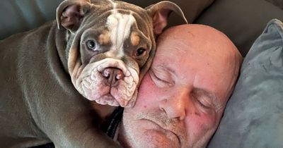 Builder's big toe chewed to the bone by bulldog puppy as he slept on the couch
