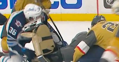 NHL star plays on after needing 75 stitches in locker room for horror facial injury