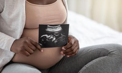The Guardian view on race and maternal health: a systemic problem