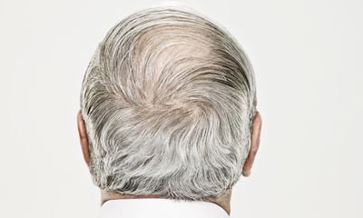 Scientists may have discovered why hair turns grey