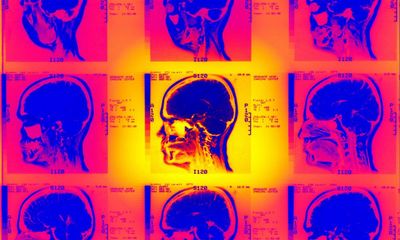 Top 10 medical memoirs … by patients