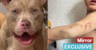 Hero neighbours drag XL bully dog off boy, 3, during horror attack by grabbing genitals