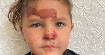 Hero neighbours drag XL bully dog off toddler by grabbing genitals during attack