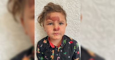 Dog 'would have killed' boy, 3, if it wasn't for hero neighbours