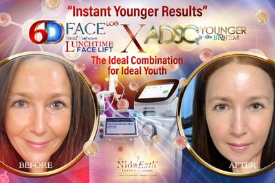 ‘Instant Younger Results’