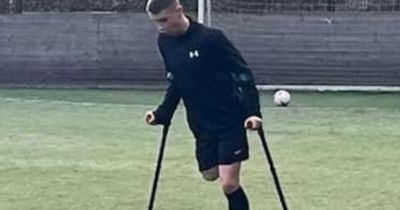 'Amazing' Glasgow doctors amputate schoolboy's leg and keep his football dream alive