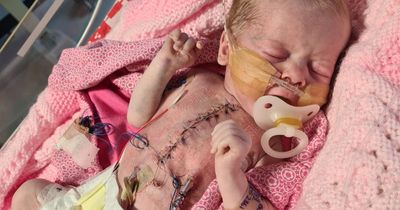 Heartbroken mum wants poorly baby home as she's spent every day of her life so far in hospital