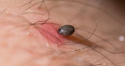 Everything you need to know about tick-borne virus now seen in UK