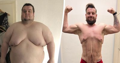 Man who weighed 582lbs loses 26stone after surgery and one lifestyle change