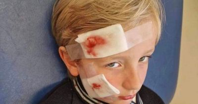 Boy, 7, suffers horror injuries after dog bites him in face and head at pet shop